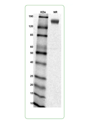 MW: Molecular Weight marker reduced condition
NR: GHR dimer under non-reduced condition